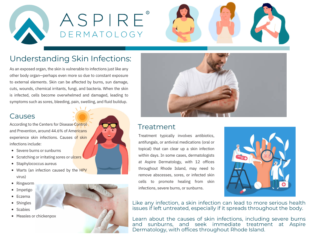 Skin Infections Image blog